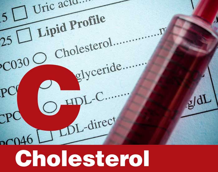 Cholesterol